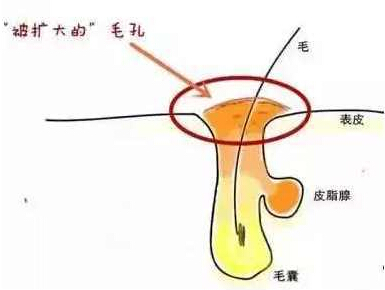 Stay Lounge Chair - Large休閑椅